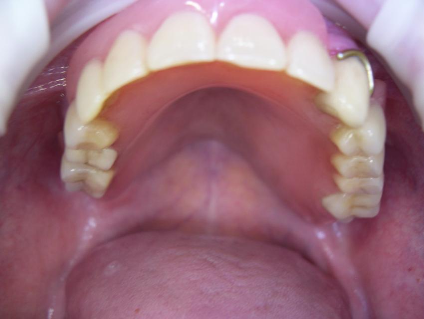image12