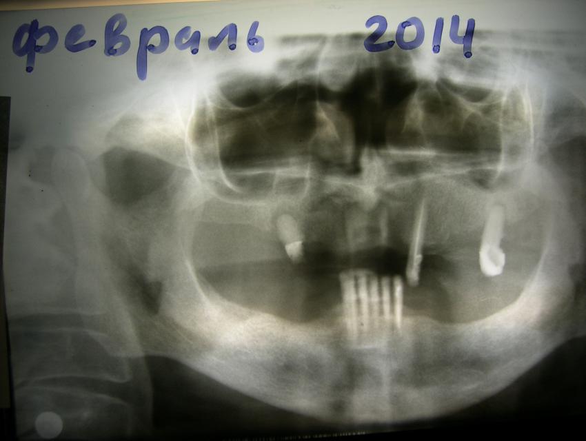 image4