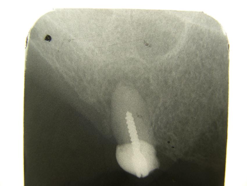 image6