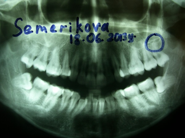 ganulemy 5