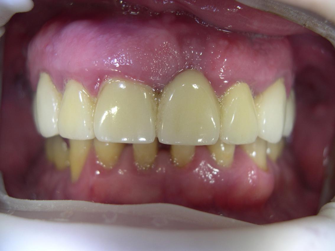 image5