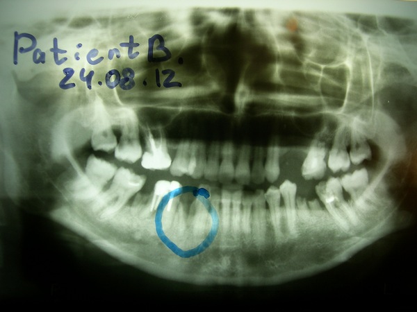 pacient 10 2