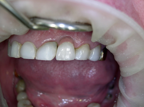 pacient 6 10