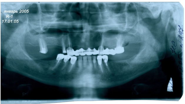 image1