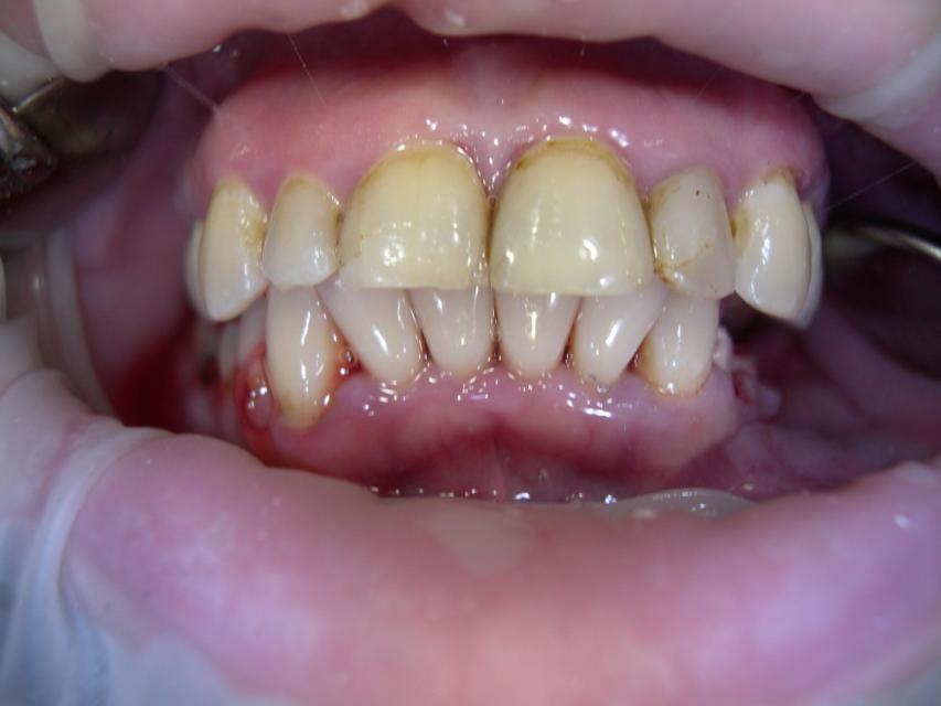 image1