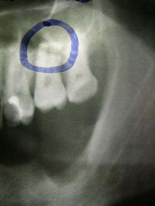 image1