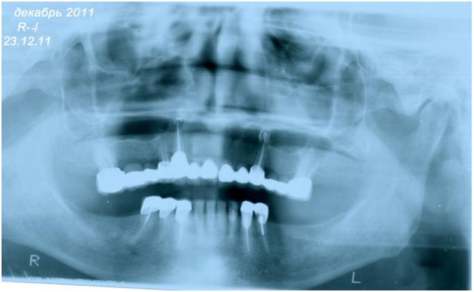 image8