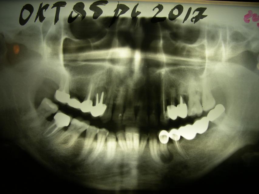 image10
