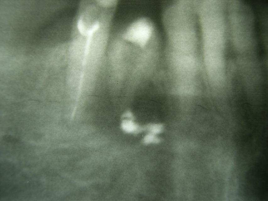 image33