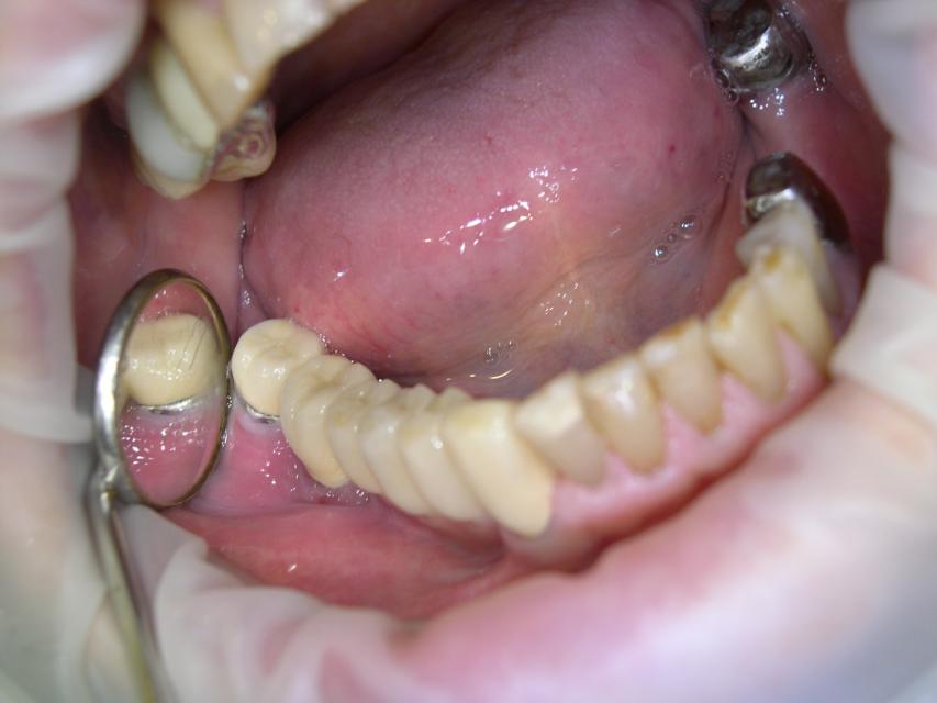image37