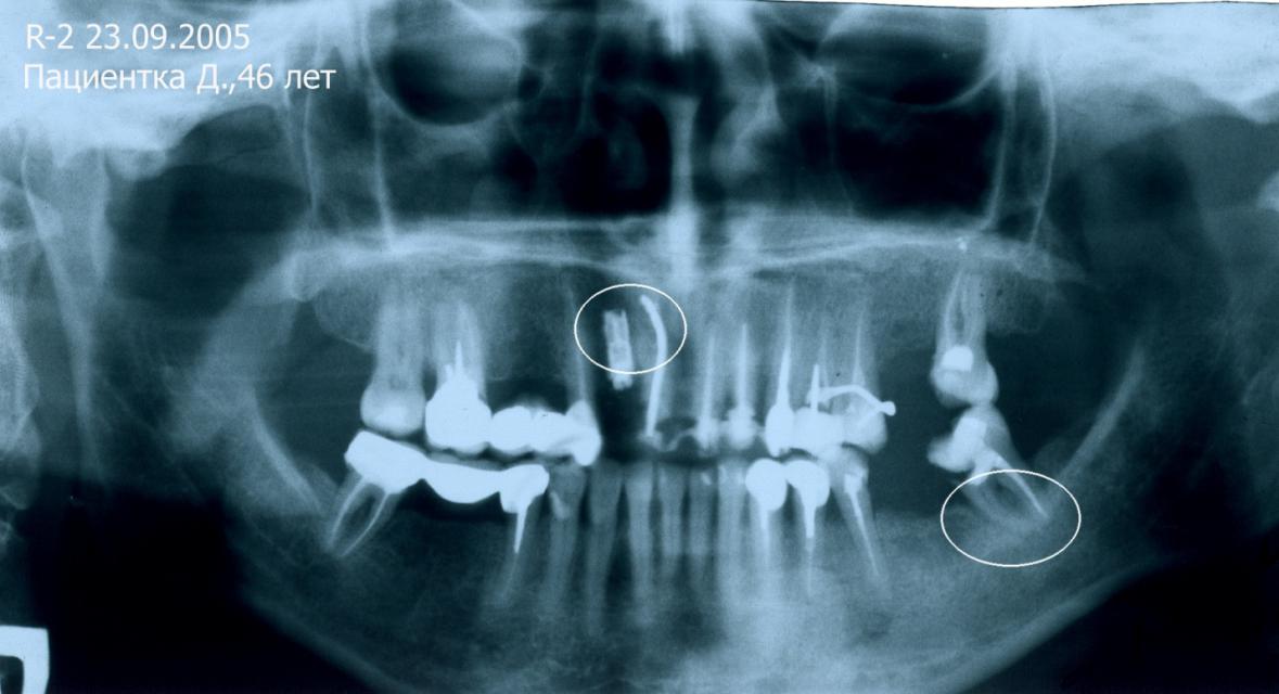 image9